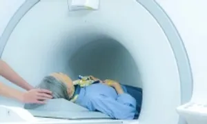 Chuyên gia: 'Không phải ai cũng nên chụp CT tầm soát ung thư, đột quỵ' Chuyên gia: 'Không phải ai cũng nên chụp CT tầm soát ung thư, đột quỵ'